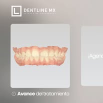 Avance del tratamiento